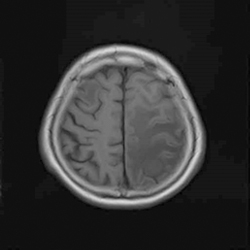 MRI造影剤