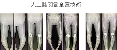 画像５